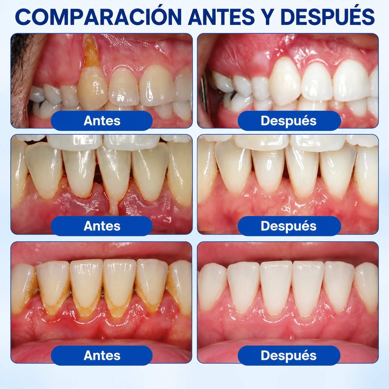 Gel de Reparación Periodontal - Recuperá el Cuidado de tus Encías y Volvé a Sonreír con Confianza