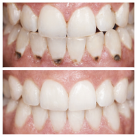 Sérum Reparador Dental – Repara el daño rápido