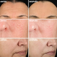 Bálsamo Multiacción para Arrugas - efecto lifting instantáneo, brillo duradero