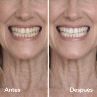 Sérum Reparador Dental – Repara el daño rápido