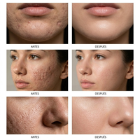 Mascarilla Purificante de Té Verde – Piel Más Clara en Minutos