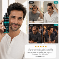 Foltivex - Protegé cada folículo. Recuperá cada hebra.
