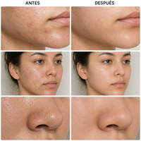 Mascarilla Facial Purificante en Barra de Té Verde – El brillo empieza con una piel limpia.