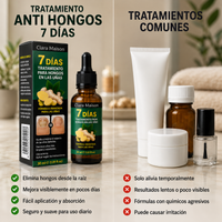 Tratamiento Anti Hongos 7 Días - Recupera unas uñas sanas y fuertes.