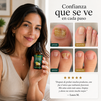 Tratamiento Anti Hongos 7 Días - Recupera unas uñas sanas y fuertes.