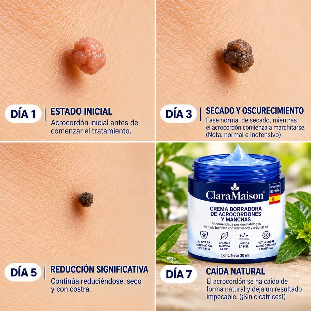 ClaraMaison® CREMA BORRADORA DE ACROCORDONES Y MANCHAS -Sin dolor y sin cicatrices · Crema de alta calidad contra las imperfecciones de la piel